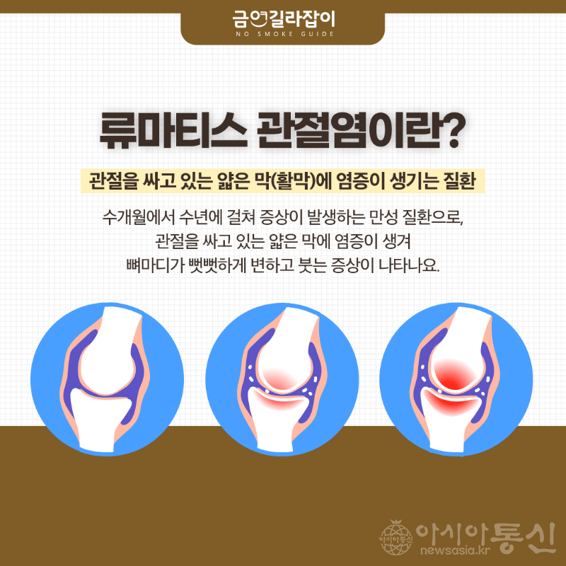 류마티스관절염.png
